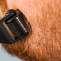 These Beard Growth Products Are at the Top of My Wishlist, & Right Now They’re 35% Off